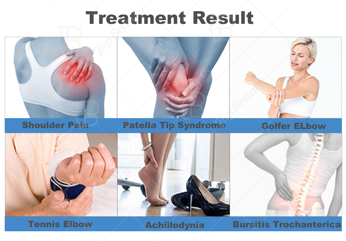 Therapy Machine knee pain relief/pain relief device/body massager machine