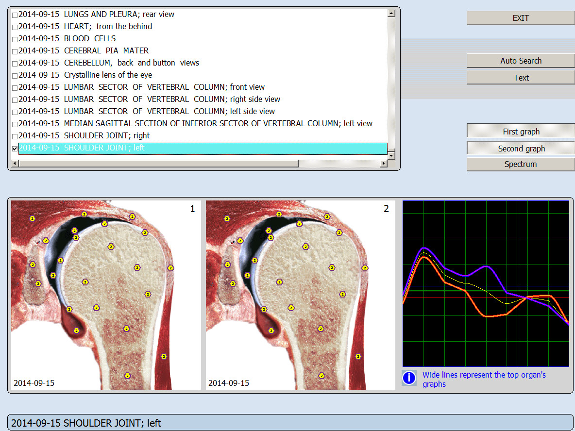 Automatic NLS Vector Bioresonance Health Diagnostic and Test Machine For Villas And Offices