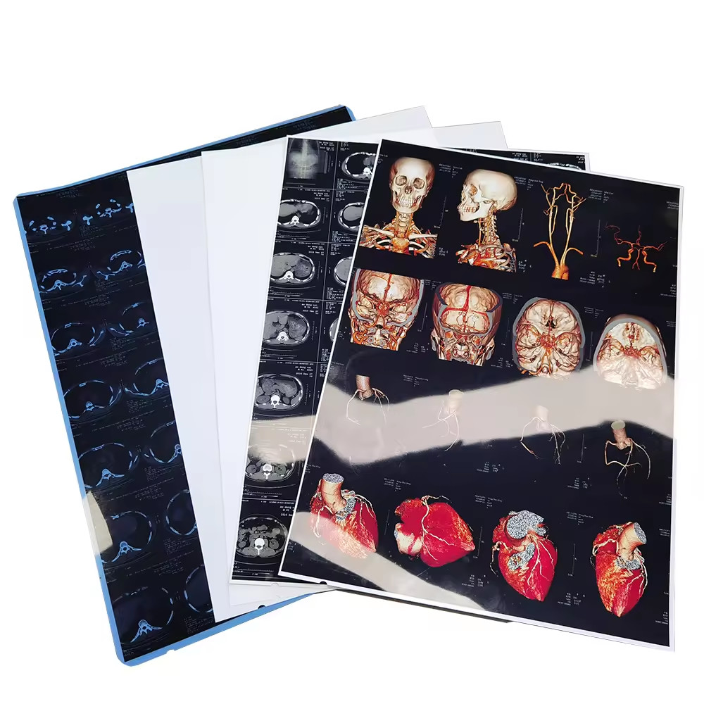 150 Microns White Film Thickness Inkjet X Ray Film For Printing Technology