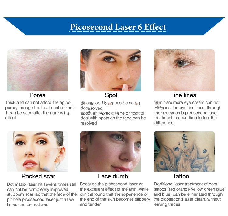 Picosecond Carbon Laser Peel Machine
