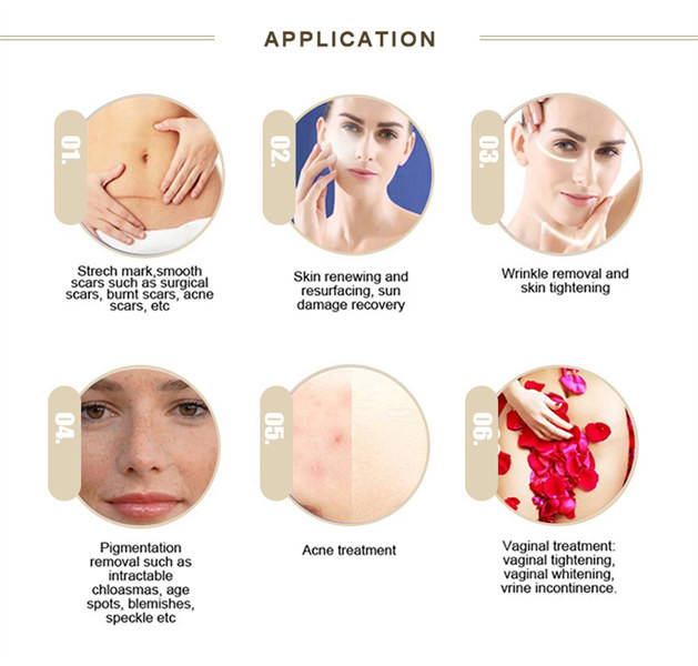 Freckle Removing Co2 Fractional Laser Equipment 40W Chloasma Treatment