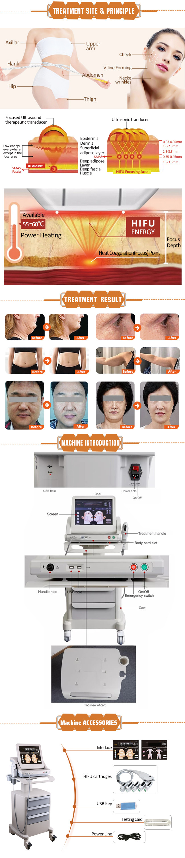 ABS 7d Vertical Hifu Body Slimming Machine High-Intensity Focused Ultrasound