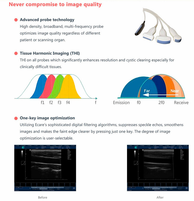 4D Color Doppler Ultrasound Scanner with 3.5MHz / R40 Volume Probe