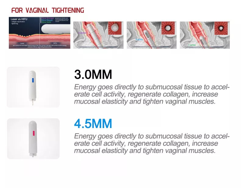 Women Hifu Beauty Machine For Vaginal Tighten 360 Degree Rotating