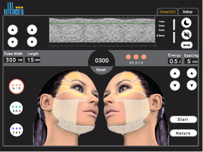 Skin Rejuvenation Machine Face Wrinkle Removal Machine Jowl lifting