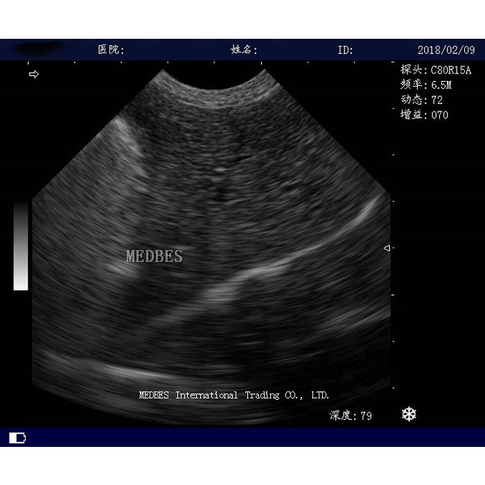 Trolley Medical Diagnosis Equipment M-B350T trolley B/W ultrasound scanner
