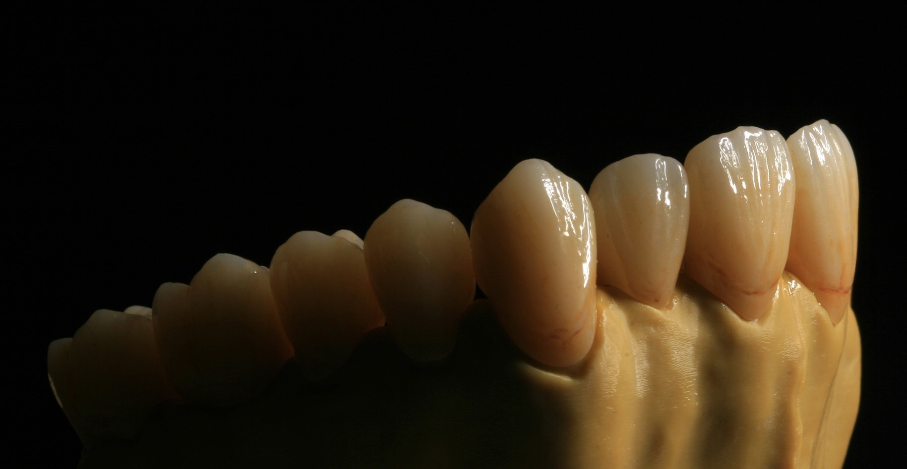Dental Lab Porcelain Zirconia Dental Crown 5 Stars Esthetics
