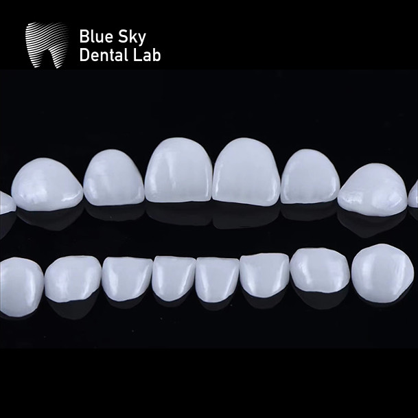 EMax Veneer Cases Passive Fitting In Multiple Colors MAKE Beautiful Smile With Minimal Tooth Preparation