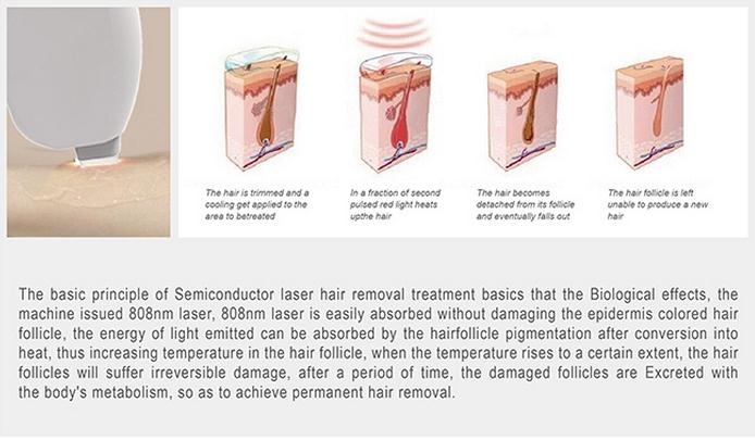 808nm Hair Removal Laser For Men / Women With 12 * 20 mm Big Spot Size