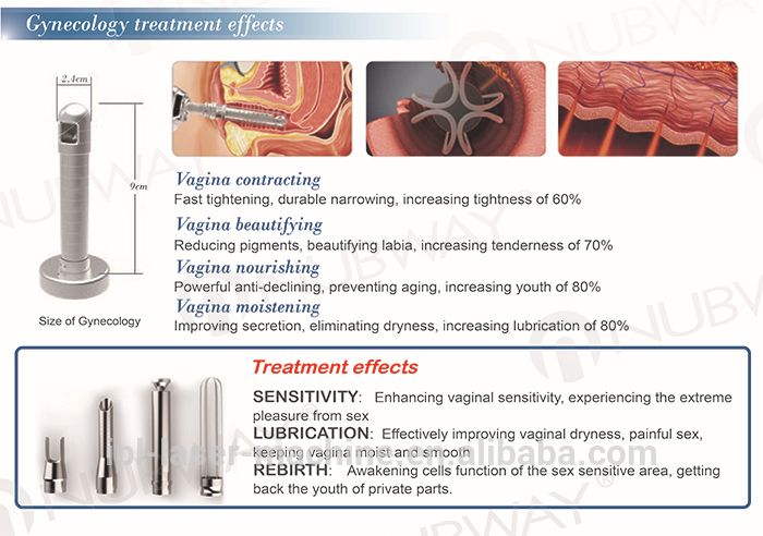 vaginal lifting machine.jpg