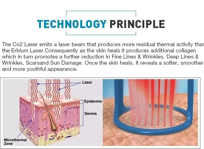 Body Facial Co2 Fractional Laser Equipment , 10600nm Medical Beauty Equipment