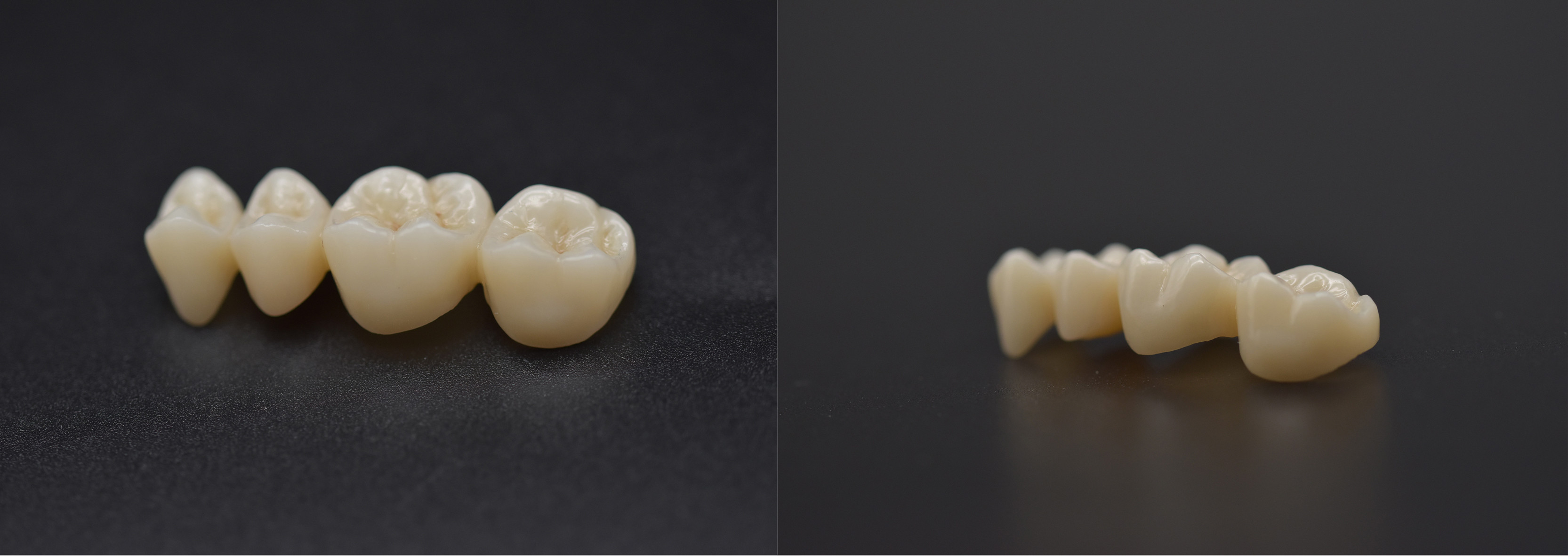 Dental 6.07g/cm³ ST Pre Shaded Zirconia Blocks