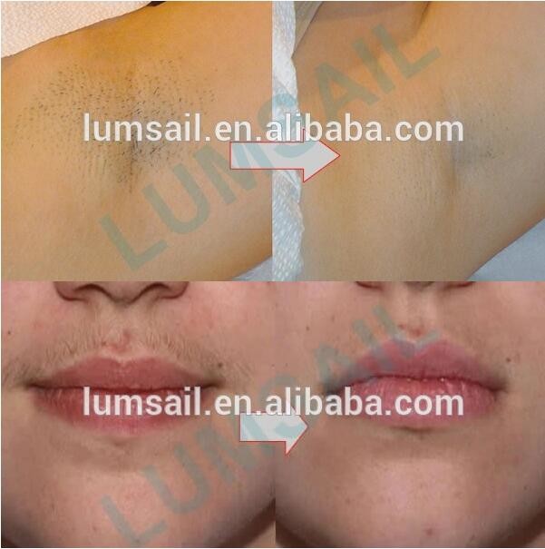 Touch Cooling IPL Laser Hair Removal Machine / Skin Rejunvation Machine Painless