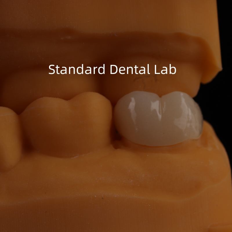 5-Year Guarantee Full Contour Zirconia Crown for Molar Teeth Noritake Porcelain Made in by Trusted Dental Laboratory