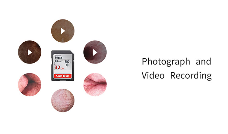 Flexible Video Ureteroscope Urological