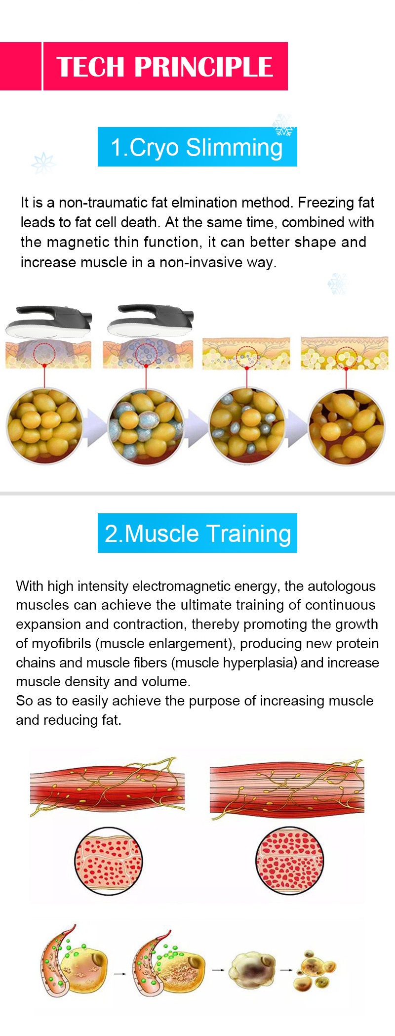 4 Handles Muscle Sculptinging Machine Slimming RF Body Contouring Device