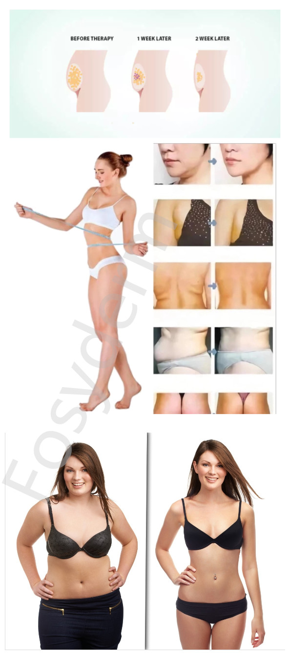 Lipolysis Injection Lipolytic Solution For Weight Loss Fat Dissolving 10ml / Vial
