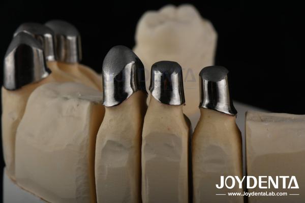Steel Locator Dental Attachments , Precision Partial Denture Attachments