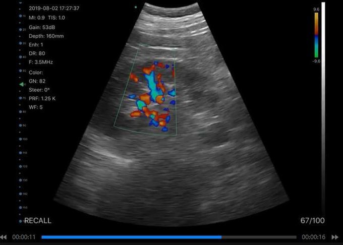 Support Printing Reports Handheld Ultrasound Scanner 13 Application 6 Language App Free IOS Android Windows Compatible 2