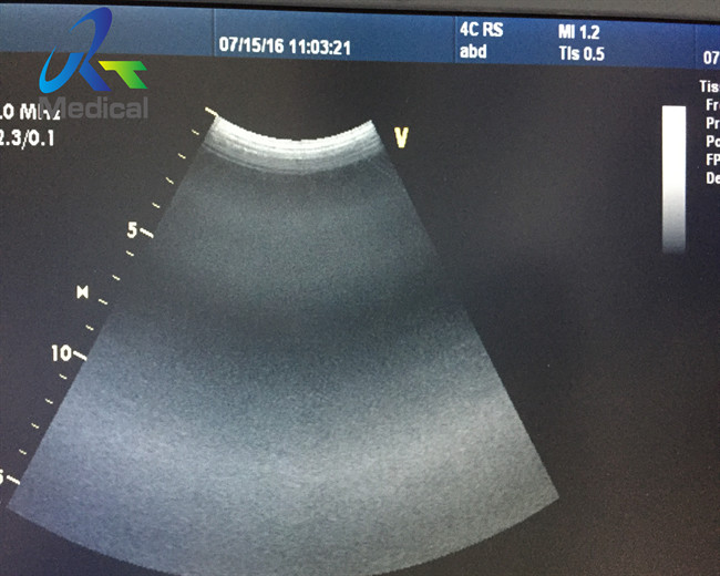 GE 4C-RS convex array Logiq e Logiq F6 ultrasound transducer probe