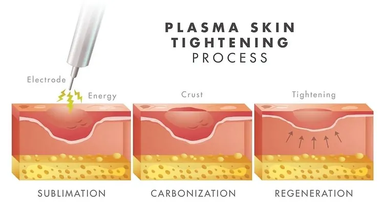 Hot Cold 2 In 1 Plasma Machine For Facial Lifting Therapy Hot Cold Plasma
