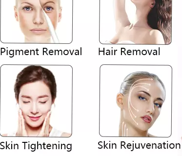 Chinese new products beauty equipment diode 808nm laser hair removal machine for sale