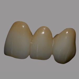 Natural Full Contour Zirconia Bridge Single Unit / Multiunit Wear Resistant