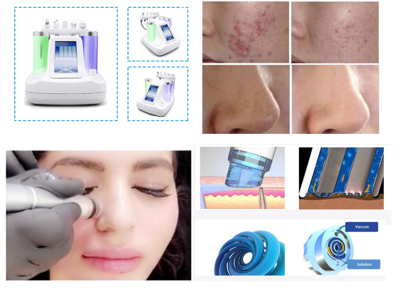 33*37*40cm Water Oxygen Jet Peel Machine Hydra Diamond Dermabrasion Beauty Machine