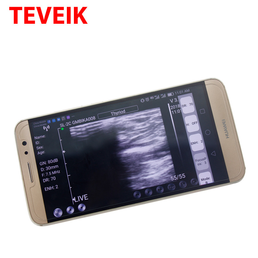 CE USB Ultrasound Machine Laptop Tablet Ultrasound Scanner Convex Probe