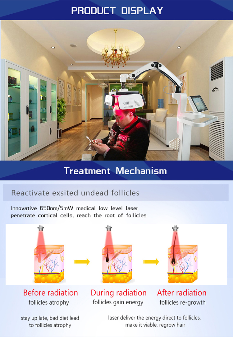 Diode LLLT Laser Hair Growth Machine 650nm Alopecia Baldness Treatment