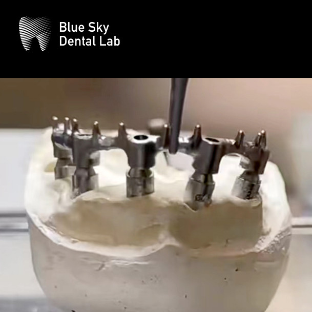 Blue Sky Dental Implants Silver Titanium Bar For Dental Implants