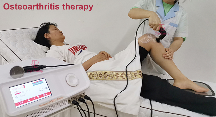 Deep 448khz Diathermy Tecar Therapy Machine For Plantar Fasciitis