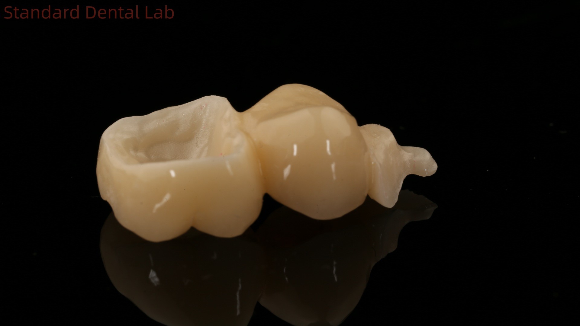 Dental Digital Full Zirconia Crown With 3D Print Model SDL Dental Lab Zirconia Onlay