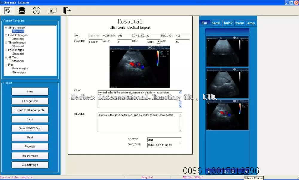 New Arrival Hospital 10.4 Inch Ultrasound echography