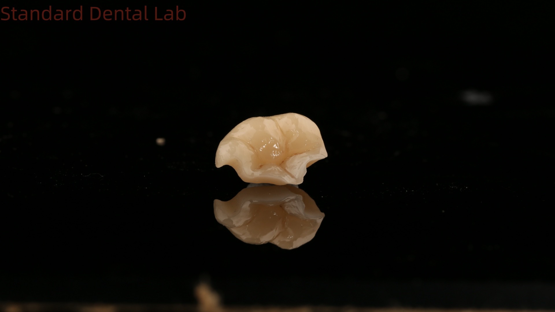 Strength Emax Ceramic Crown Dental Onlay with Excellent Stain Resistance China Dental Lab