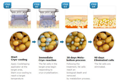 600W Cryolipolysis Fat Freezing Machine For Double Chin Therapy