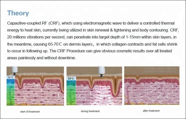 Skin Rejuvenation RF Thermage Machine Professional For Wrinkle Removal Treatment