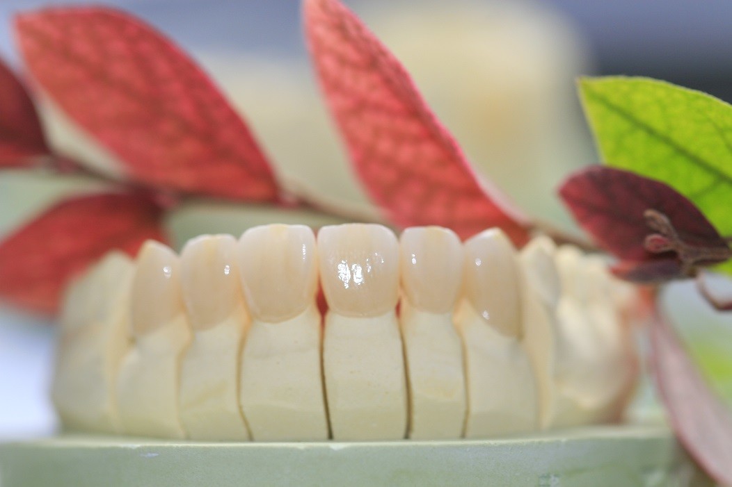 Dental Lab Porcelain Zirconia Dental Crown 5 Stars Esthetics