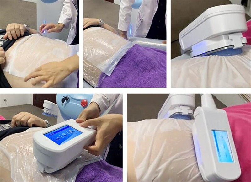 Portable Fat Freezing 360 Cryolipolysis Slimming Machine Dual Handles