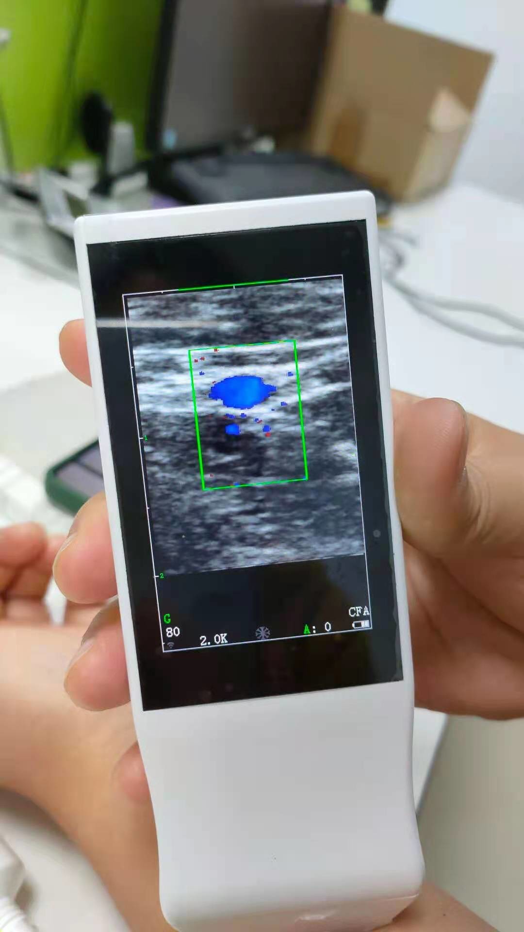 Medical Wifi Ultrasound Machine Android Portable Wireless Ultrasound Probe Linear