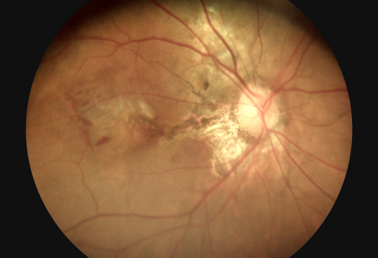 3 Lens Available Ophthalmic Equipment Digital Fundus Camera Eye Surface Camera Eye Anterior Lens Replaceable