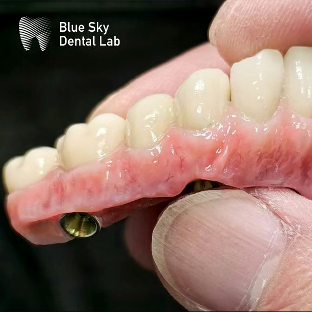 Customize Color Implant Cases with Smooth Surface Nature Design for Universal Compatibility