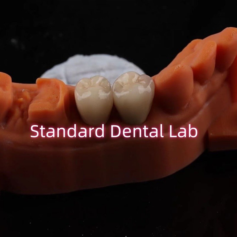 Metal Post Core Crown CAD CAM Porcelain / Zirconia Coping Full Zircnonia Bruxier Crowns