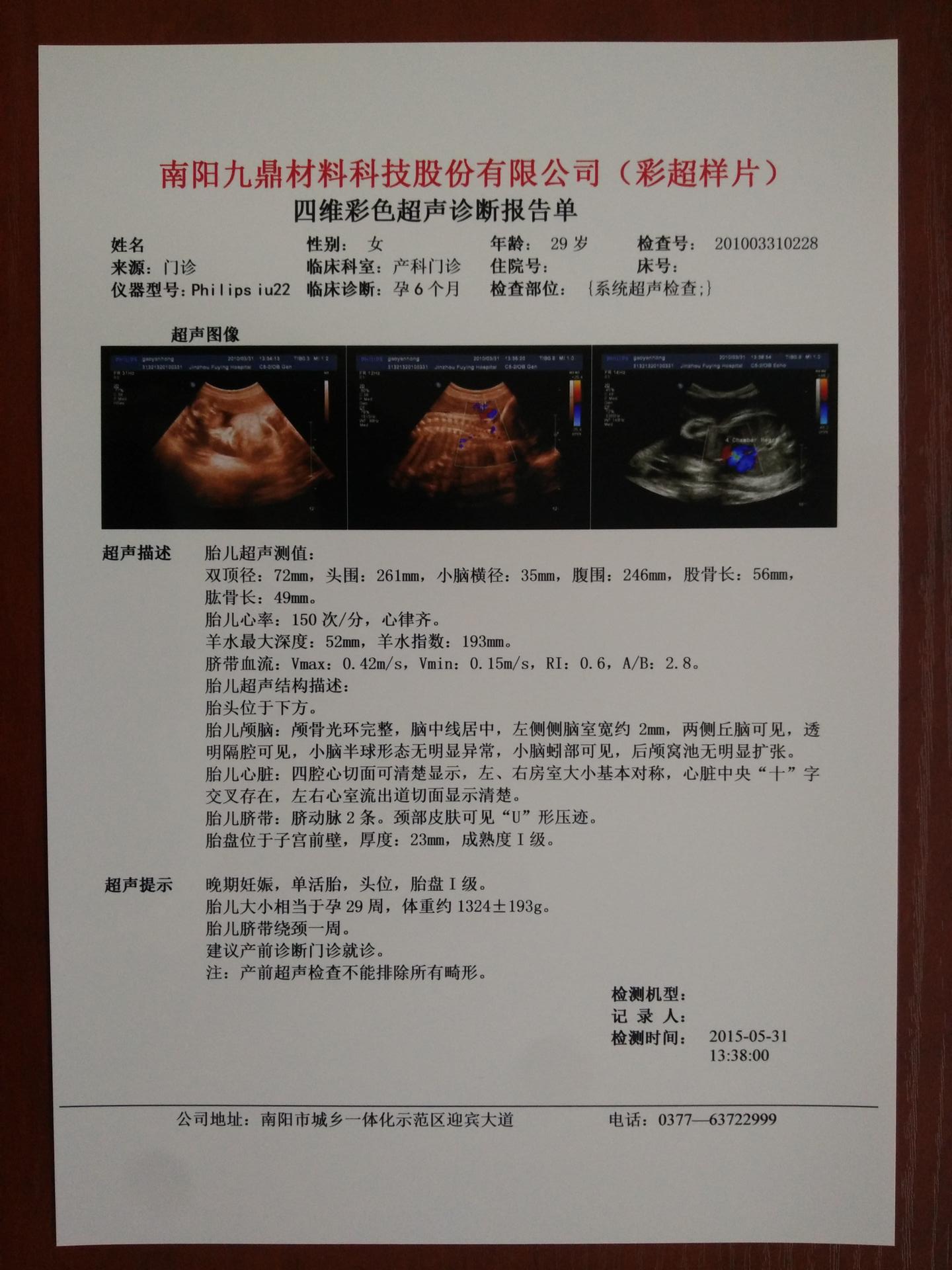 Blue PET Based Thermal Inkjet X Ray Film Medical Images For Clinic Hospitals