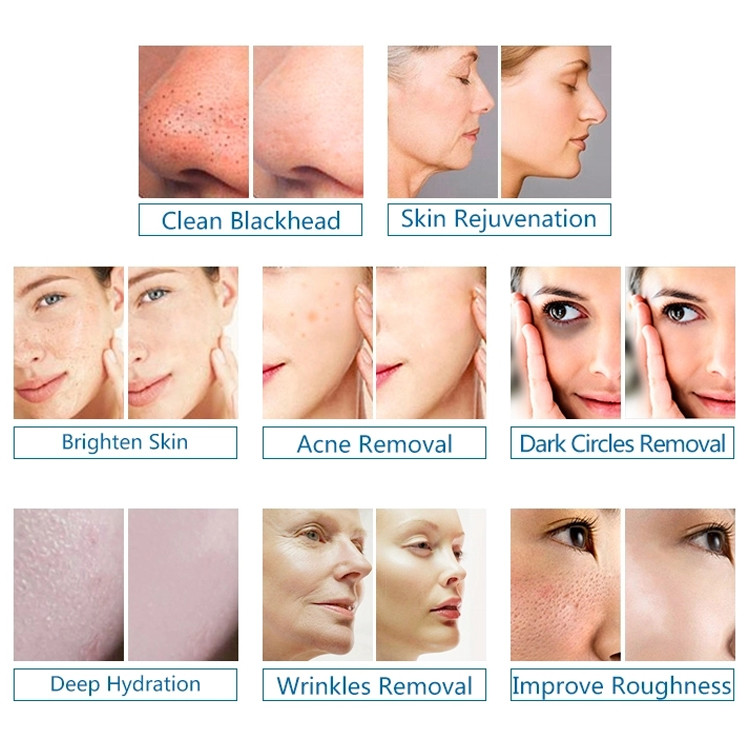 Multifunctional Hydrogen Oxygen Facial Machine Skin Peeling Mask