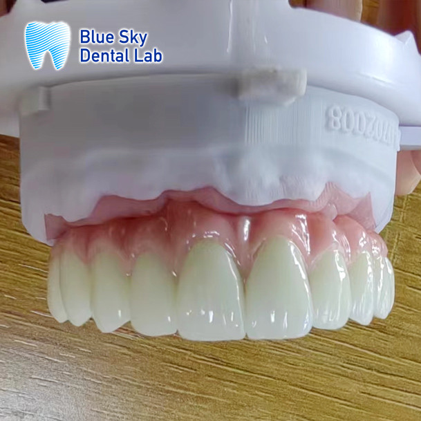 Universal Compatibility Implant Cases Customize Full Mouth Implant Case