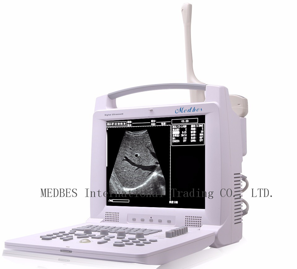 96 elements 12 inch LED Monitor Laptop Ultrasound Scanner