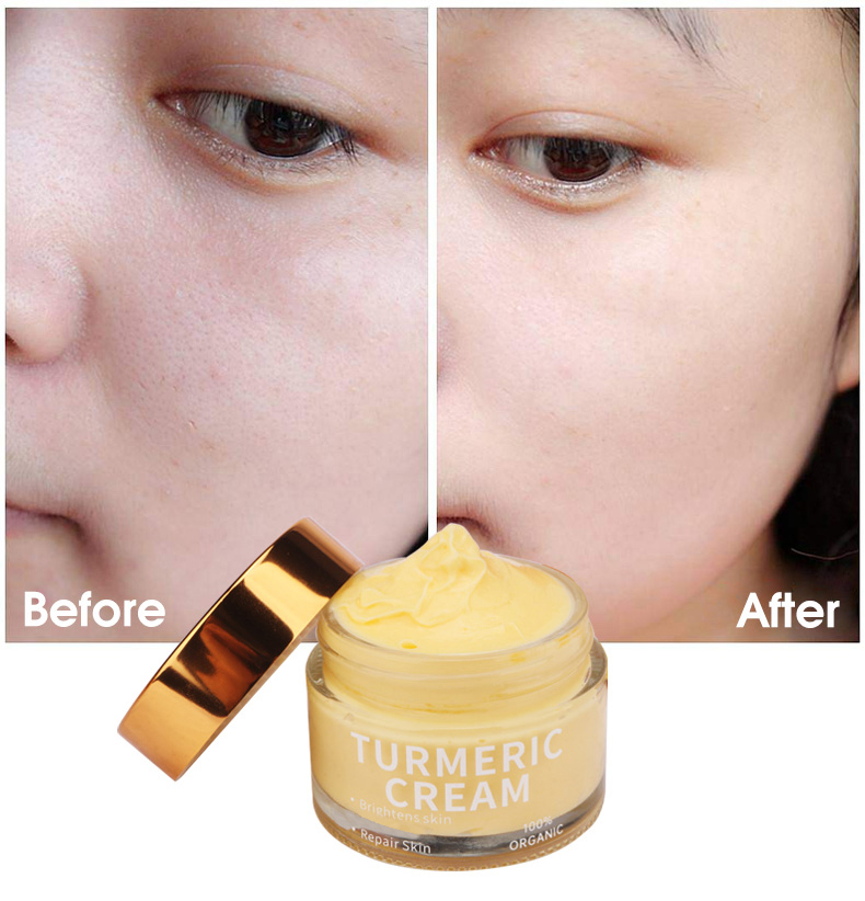 Organic Skin Care Acne Wrinkle Dark Spot Moisturizer Bleaching Turmeric Face Cream