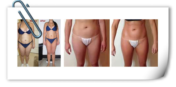 Nubway 5 Cryolipolysis cooling handles tech fat freezing machine for whole body slimming