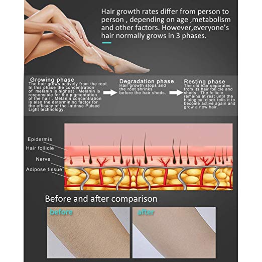 LCD Display Women'S Hair Removal Machine At Home Laser Hair Removal For Face